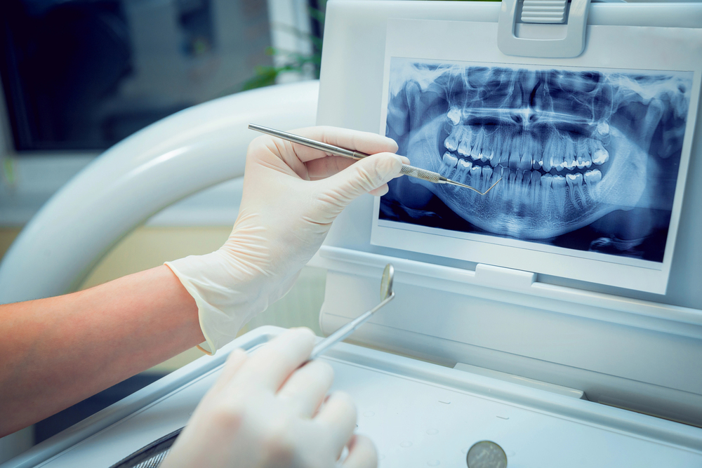 Understanding The Digital Dental Workflow: From Scan To Restoration